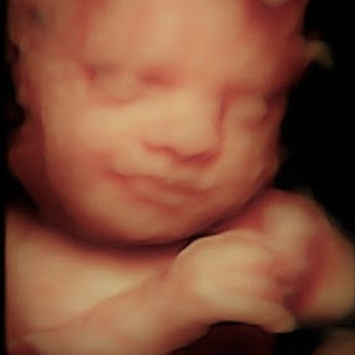 Bundle of Love 3D/4D/5D Ultrasound Studio & Baby Boutique - Gastonia | Health & Medical | Logo